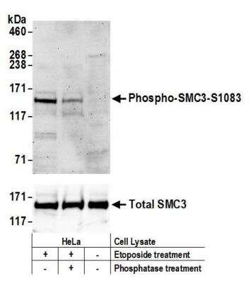 Western Blot: SMC3 [p Ser103] Antibody [NBP2-37694] - Detection of human Phospho SMC3 (S1083) by western blot (WB). Samples: Whole cell lysate (50 ug) from HeLa cells treated with 100 uM EPE and/or 100 uM phosphatase for 4 hours (+) or mock treated (-) cells. Antibodies: Affinity purified rabbit anti-Phospho SMC3 (S1083) antibody NBP2-37694 used for WB at 1 ug/ml (upper panel); to detect total SMC3, another rabbit anti-SMC3 was used for WB at 0.1 ug/ml (lower panel). Detection: Chemiluminescence with an exposure time of 3 minutes (upper panel) or 10 seconds (lower panel).